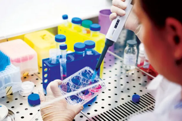 أداة تكشف التغيرات في خلايا الدم التي يسببها الضغط (الجامعة الوطنية للعلوم والتكنولوجيا بروسيا)