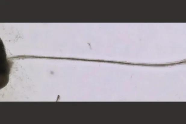 عينة لشعر نبتت من البصيلات في المختبر (جامعة يوكوهاما)