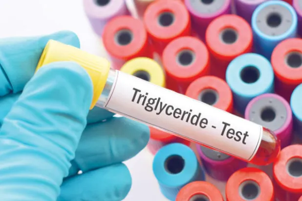 أدوية لتخفيض الدهون الثلاثية