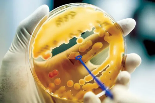 بكتيريا الكلبسيلة الرئوية حيرت العلماء لعقود