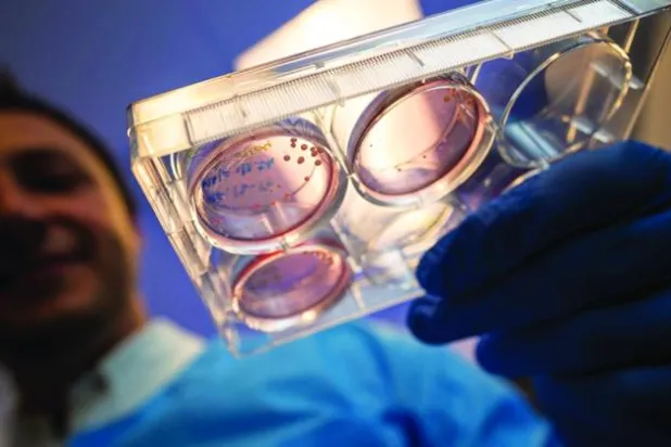 أليسون موتري يحمل صينية بها أشباه عضيات الدماغ البشري المشتقة من الخلايا الجذعية (جامعة كاليفورنيا)