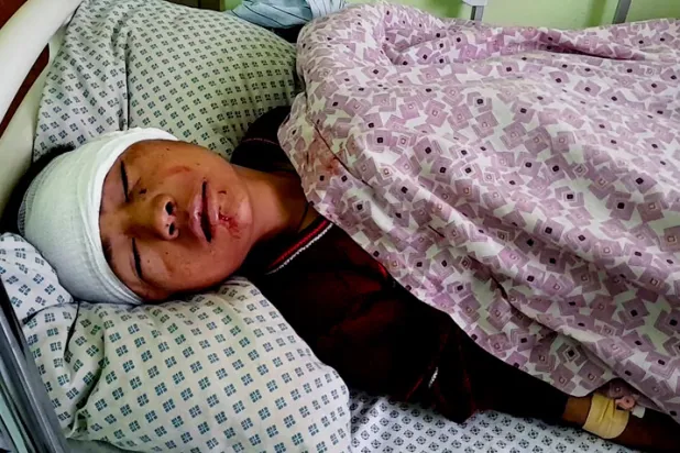 صبي يتلقى العلاج في مستشفى بعد إصابته بالإنفجار في المدرسة الدينية، أمس (أ. ب)