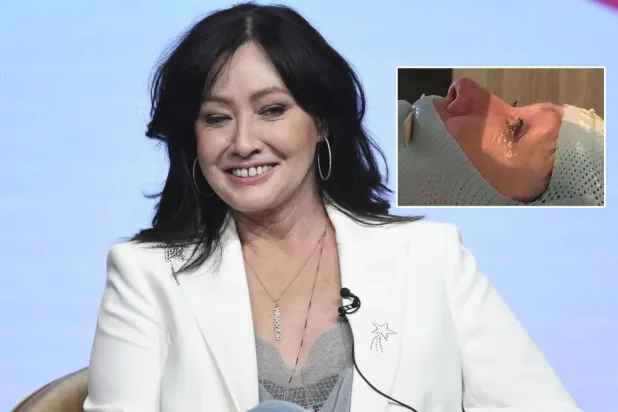 "Hollywood'un kötü kızı"nın iki yıllık ömrü kaldı: Kanser beyne yayılmış