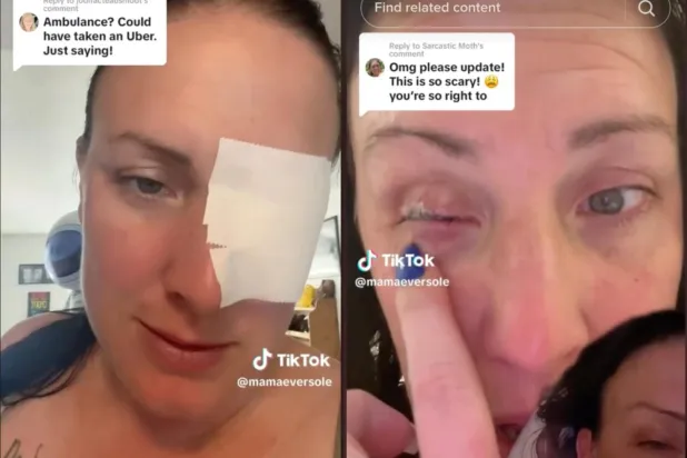 Gözüne damla yerine yanlışlıkla yapıştırıcı sıktı: "En aptal insan ödülünü kazandım"