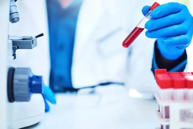 تحديد 36 بروتيناً بالدم تتنبأ بسرطان الرئة (غيتي)