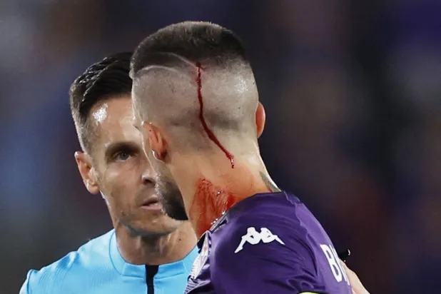 الدم كان يسيل بغزارة من رأس بيراغي فور سقوط المقذوف على رأسه (رويترز)