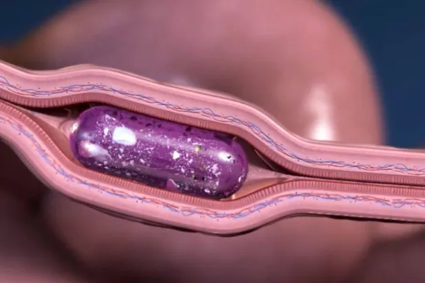 حبوب روبوتية تحقن الدواء في الأمعاء (شركة «راني ثيرابيوتكس»)