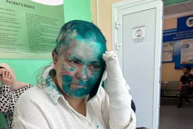 صورة تظهر الصحافية الاستقصائية الروسية إيلينا ميلاشينا في مستشفى بالعاصمة الشيشانية غروزني في 4 يوليو 2023 بعد تعرضها لاعتداء في الشيشان حيث ذهبت للقيام بتغطية صحافية (أ.ف.ب)