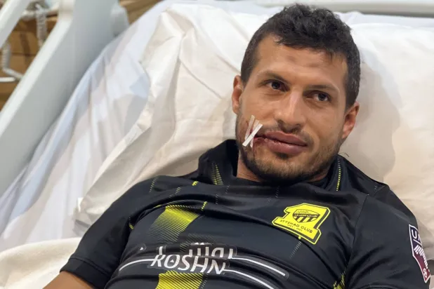 حامد خضع لجراحة ناجحة في الوجه بعد إصابته أمام الصفاقسي (نادي الاتحاد)