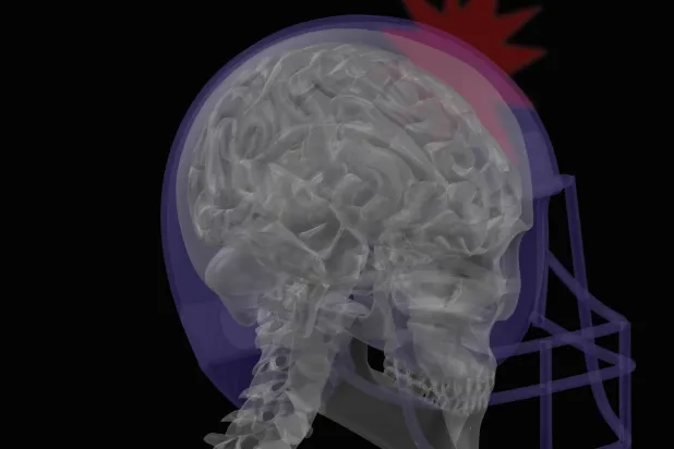الدراسة توصلت إلى أنه يمكن تشخيص الإصابة من خلال الأمعاء (غيتي)