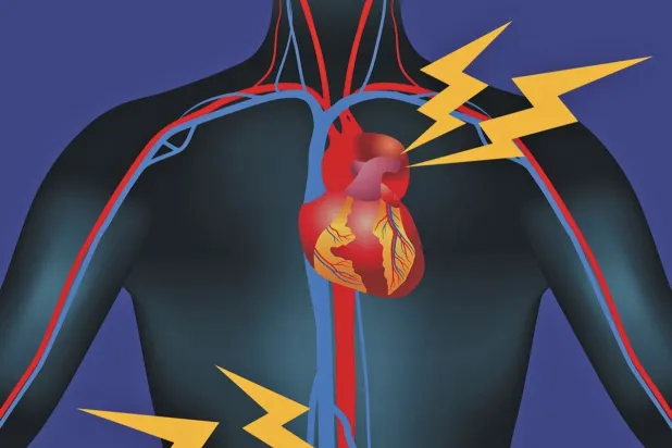 تسلُّخ وتمدُّد الشريان الأبهر يهددان بالموت