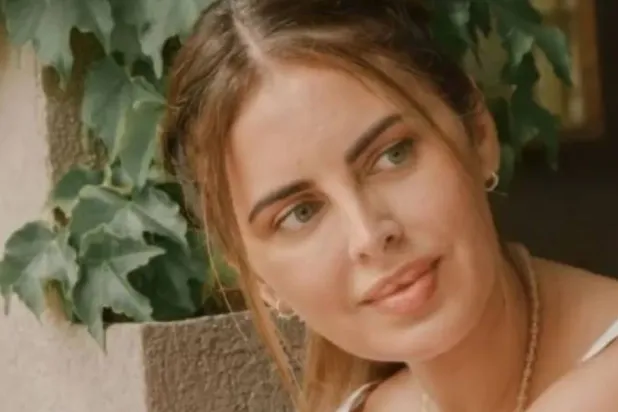 الممثلة سيلفيا لونا ضحية عمليات التجميل في الأرجنتين