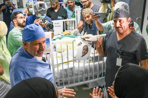 فصل حسن وحسين في سرير مستقل لكل واحد منهما بعد 12 ساعة على العملية (واس)