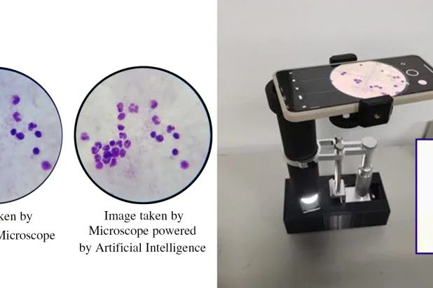 Professor Seedahmed Sharif Mahmoud - AI-Powered Microscope: A Milestone in Global Healthcare (Asharqalawsat)