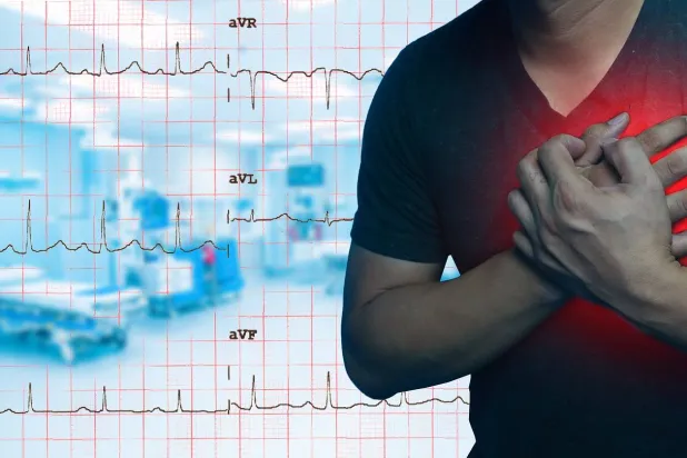 أمراض القلب والأوعية الدموية تظل السبب الرئيسي للوفاة حول العالم (إيليت هوسبيتال كينوود)