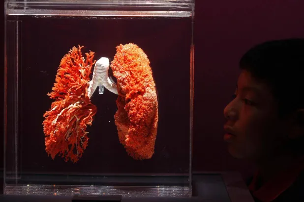 الهواء الملوث يحتوي على عنصرين يحدثان تغيرات في مسارات التنفس لدى الأطفال ويؤدي إلى إصابتهم بالربو (رويترز)