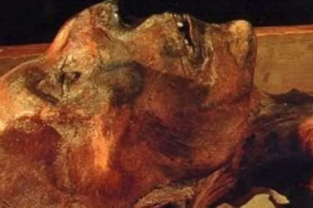 تشريح رقمي لعظام رمسيس الثاني يكشف عن ميزات مذهلة