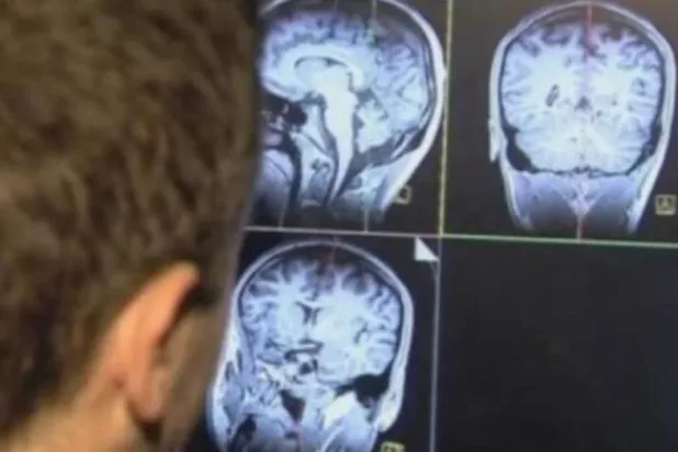 عالم يفحص تصويراً بالرنين المغناطيسي لمخ أحد الأشخاص (رويترز)