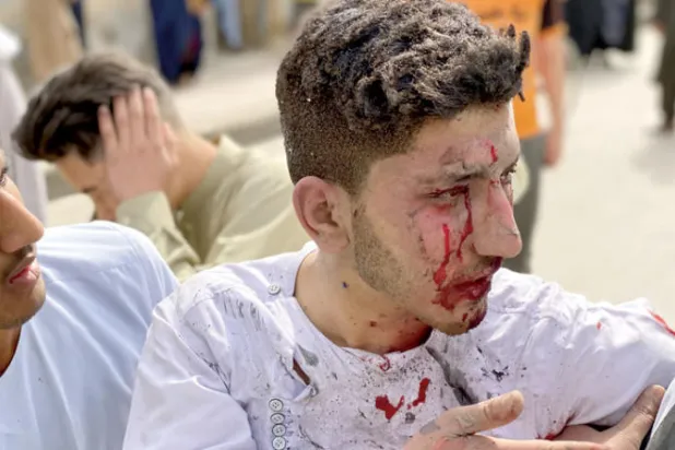 إصابات بانفجار استهدف تجمعاً لصحافيين في شمال أفغانستان