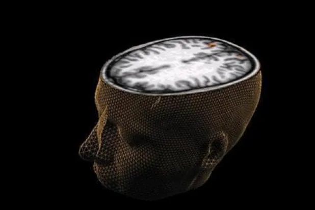 لماذا لا يمكن الاعتماد على الذاكرة البشرية حتى على المدى القصير؟