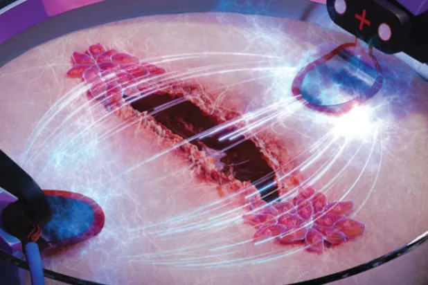 الكهرباء تشفي الجروح أسرع بثلاث مرات