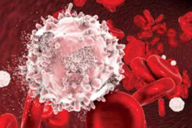 تركيبة تنهي مقاومة خلايا سرطان الدم