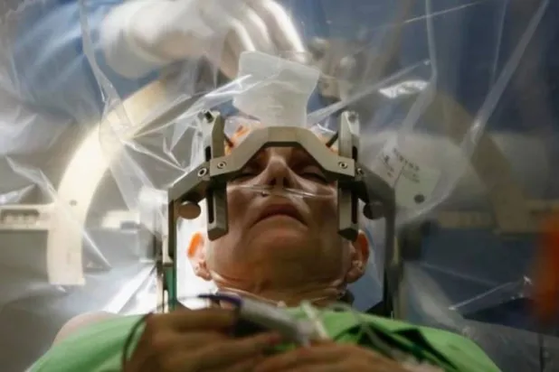 يتضمن التحفيز المغناطيسي عبر الجمجمة وضع جهاز على فروة الرأس لتوصيل نبضات مغناطيسية من الطاقة عبر الجمجمة إلى مناطق بالمخ (أرشيفية - رويترز)