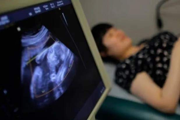 متلازمة تكيس المبايض هي حالة صحية شائعة يمكن أن تسبب عدم انتظام الدورة الشهرية والسمنة (رويترز)