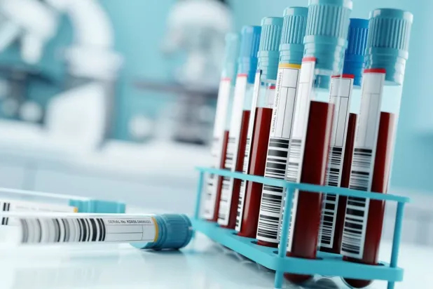 Şizofreni tedavisini iyileştiren kan testi