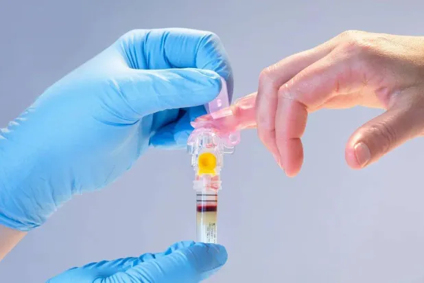 تقنيات جديدة لاختبارات الدم