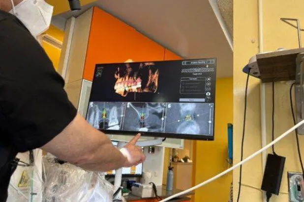 الدكتور محمد علي يستخدم برنامج التصوير الخاص بالروبوت لوضع خطة لتثبيت غرسة التيتانيوم بالزاوية والعمق الصحيحين في عظم الفك