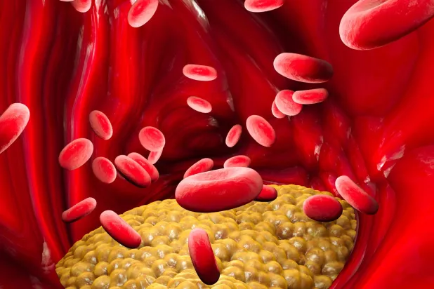 16 حقيقة عن الدهون الثلاثية