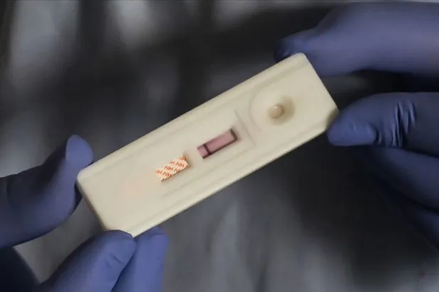 Karabük İl Sağlık Müdürlüğü'nden HIV iddialarına ilişkin açıklama