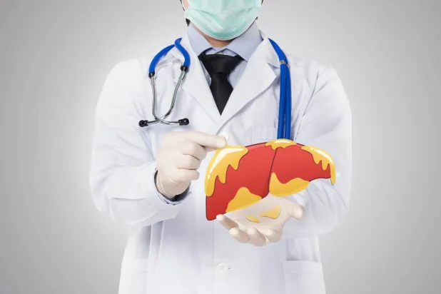 تحليل دور الجينات في مرض الكبد الدهني