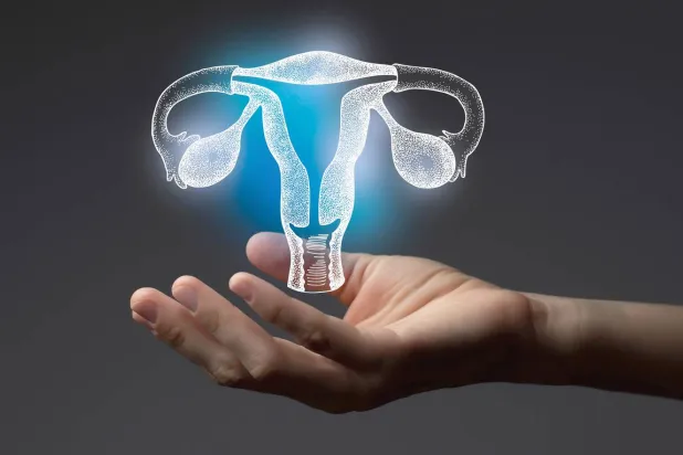 6 حقائق طبية عن مُتَلازِمة المبيض المتعدِّد الكيسات