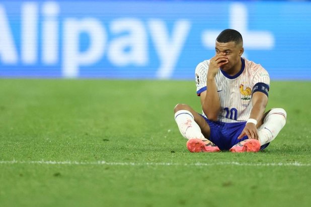 France's forward #10 Kylian Mbappé sits on the pitch after being injured during the UEFA Euro 2024 Group D football match between Austria and France at the Duesseldorf Arena in Duesseldorf on June 17, 2024. (AFP) 