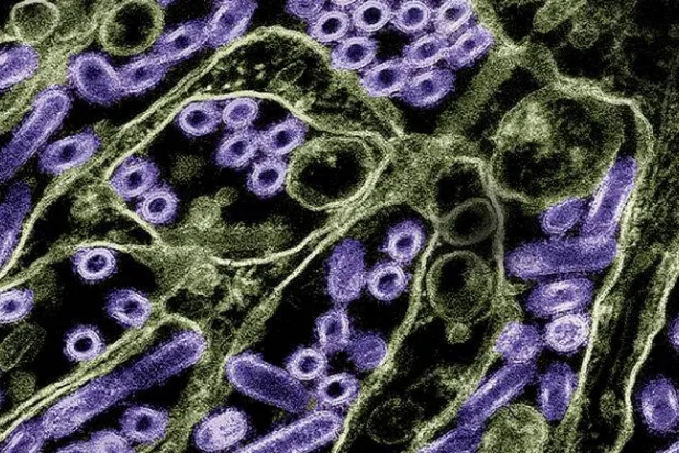 صورة مجهرية لجزيئات فيروس «إتش5إن1» من إنفلونزا الطيور باللون الأرجواني (وسائل إعلام أميركية)