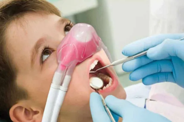 علاج تسوس الأسنان عند الأطفال يعتمد على شدة التسوس