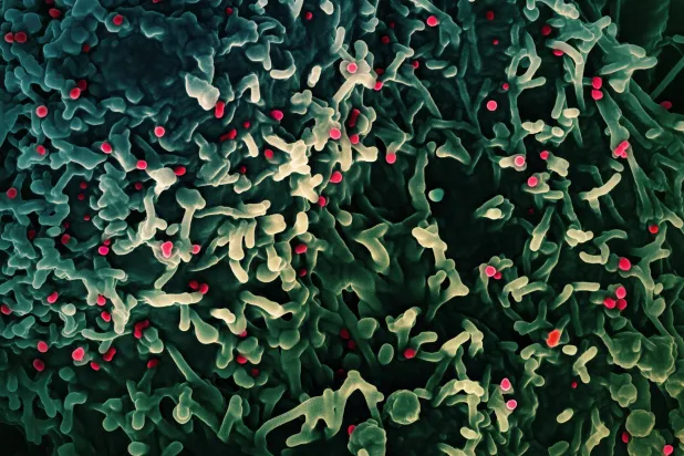 صورة مجهرية إلكترونية ملونة غير مؤرخة لفيروس جدري القردة (باللون الأحمر) على سطح خلايا «VERO E6» المصابة (باللون الأخضر) (رويترز)