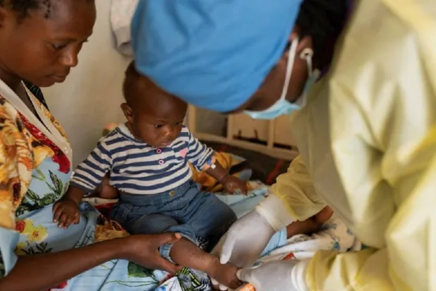 الطفح الجلدي من أبرز أعراض الإصابة بجدري القردة (رويترز)