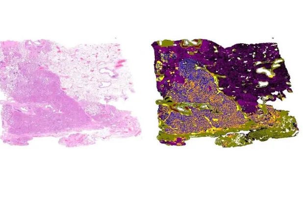 المنصّة تميّز أنواع الأنسجة بألوان مختلفة (جامعة كولونيا)