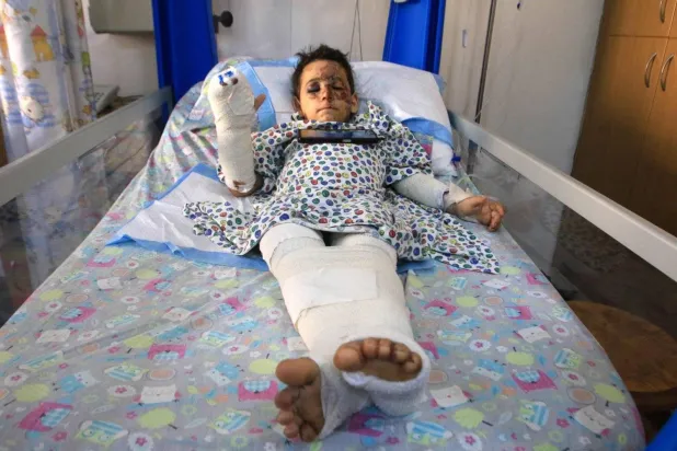 A Lebanese child injured in an Israeli airstrike lies in a hospital in Sidon, Lebanon (AFP)