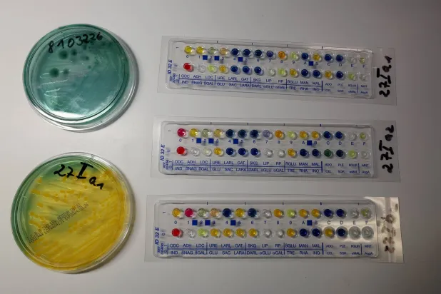 يمكن العثور على الجراثيم في المياه النظيفة والمالحة بأنحاء العالم التي قد تدخل جسم الإنسان من خلال الجروح (د.ب.أ)