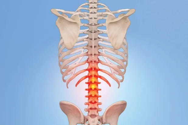 الانزلاق الغضروفي: 10 معلومات حول التعامل الطبي مع حالاته
