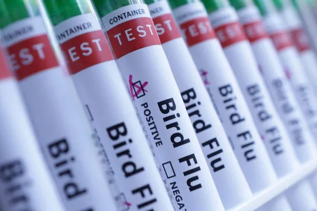 Kuş gribi virüsü için test tüpleri (Reuters)