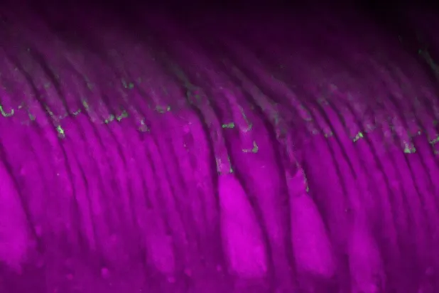 يرفع العلاج الجديد مستويات البروتين في الخلايا الحساسة للضوء بشبكية العين (هارفارد)