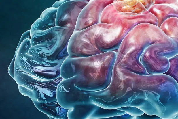 صورة توضيحية تُظهر ورماً في المخ (أرشيفية)