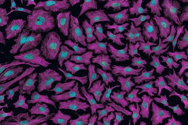 Bilim insanları kanserli hücreleri eski haline çevirerek tedavinin yan etkilerini azaltmayı umuyor (Unsplash)