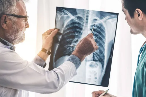 من المتوقع تشخيص أكثر من 234 ألف حالة جديدة من سرطان الرئة في الولايات المتحدة خلال 2024 (جامعة فلوريدا)