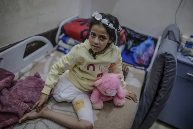 هبة مهنى فتاة فلسطينية تبلغ من العمر تسع سنوات في مستشفى شهداء الأقصى بدير البلح وسط قطاع غزة بعد أن فقدت ساقها جراء غارة إسرائيلية على منزلها (إ.ب.أ)